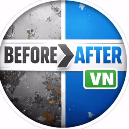 Before After VN